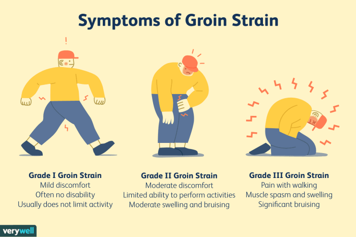 Muscle hamstring abductor tear pulled injury groin pain torn strain pull hip experience blue semitendinosus hamstrings self test